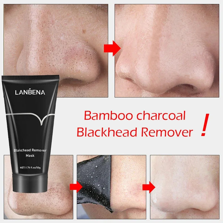 Blackhead Remover - health and beauty, skin care