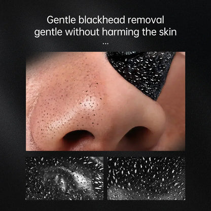 Blackhead Remover - health and beauty, skin care